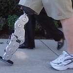 Un avance de tecnología integrada en una pierna biónica