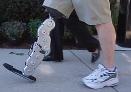 Un avance de tecnología integrada en una pierna biónica